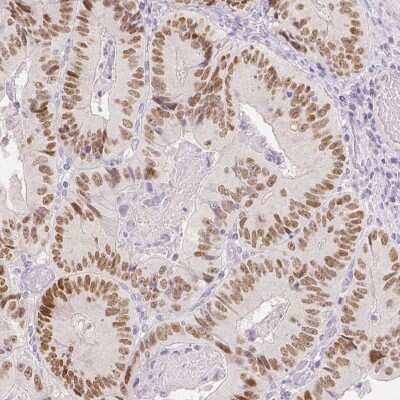 Immunohistochemistry-Paraffin: TCF-2/HNF-1 beta Antibody (CL0374) [NBP2-30678]