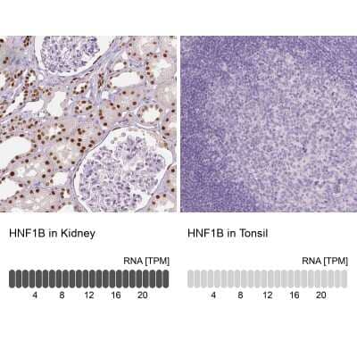 Immunohistochemistry-Paraffin: TCF-2/HNF-1 beta Antibody (CL0374) [NBP2-30678]