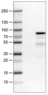 Western Blot: TCF-2/HNF-1 beta Antibody (CL0374) [NBP2-30678]