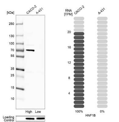 Western Blot: TCF-2/HNF-1 beta Antibody (CL0374) [NBP2-30678]