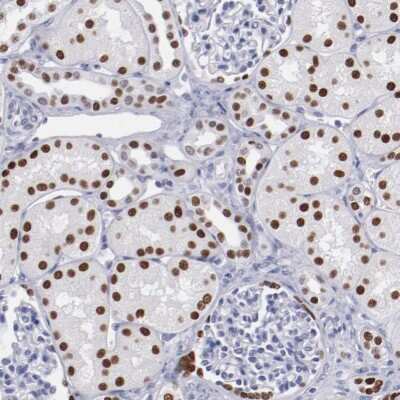 Immunohistochemistry-Paraffin: TCF-2/HNF-1 beta Antibody [NBP1-89680]