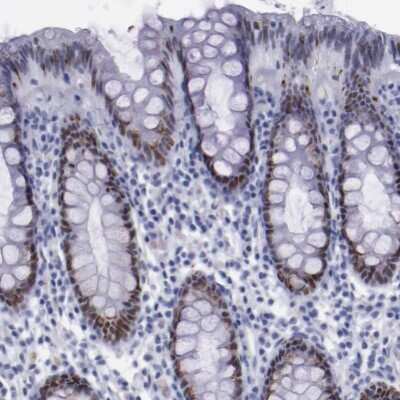 Immunohistochemistry-Paraffin: TCF-2/HNF-1 beta Antibody [NBP1-89680]
