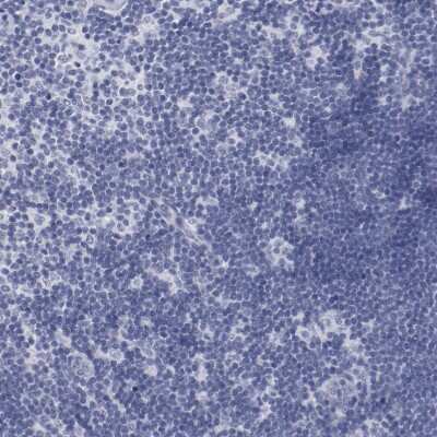 Immunohistochemistry-Paraffin: TCF-2/HNF-1 beta Antibody [NBP1-89680]