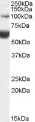 Western Blot: TCF-2/HNF-1 beta Antibody [NB100-57093]