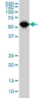 Western Blot: TCF-3/E2A Antibody (5G2) [H00006929-M01]