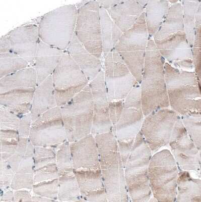 Immunohistochemistry-Paraffin: TCF-3/E2A Antibody [NBP2-38611]