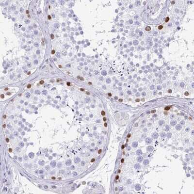 Immunohistochemistry-Paraffin: TCF-3/E2A Antibody [NBP2-38961]