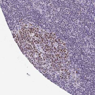 Immunohistochemistry-Paraffin: TCF-3/E2A Antibody [NBP2-38961]