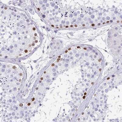 Immunohistochemistry-Paraffin: TCF-3/E2A Antibody [NBP2-38961]