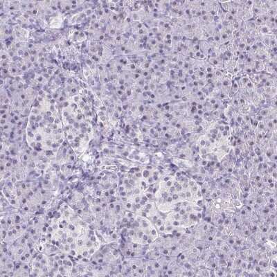 Immunohistochemistry-Paraffin: TCF-3/E2A Antibody [NBP2-38961]