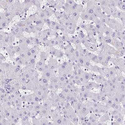 Immunohistochemistry-Paraffin: TCF-3/E2A Antibody [NBP2-38961]