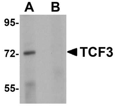 Western Blot: TCF-3/E2A AntibodyBSA Free [NBP1-77119]