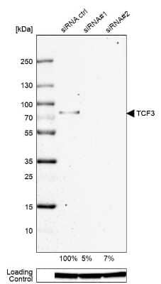 Western Blot: TCF-3/E2A Antibody [NBP2-38961]