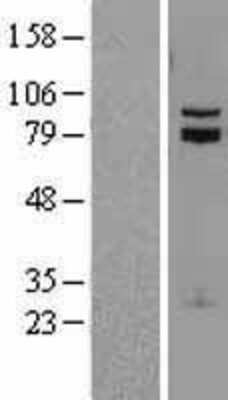 Western Blot: TCF-12/HTF4 Overexpression Lysate [NBL1-16771]