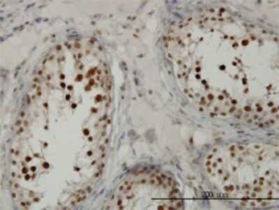 Immunohistochemistry-Paraffin: TCF19 Antibody (6D8) [H00006941-M01]