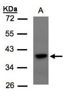 Western Blot: TCF19 Antibody [NBP1-31030]