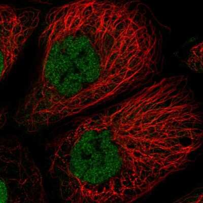 Immunocytochemistry/ Immunofluorescence: TCF20 Antibody [NBP2-31968]