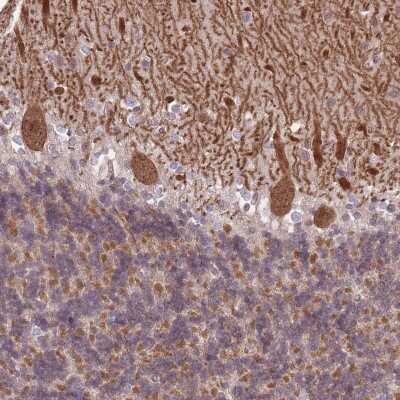 Immunohistochemistry-Paraffin: TCF20 Antibody [NBP2-31968]