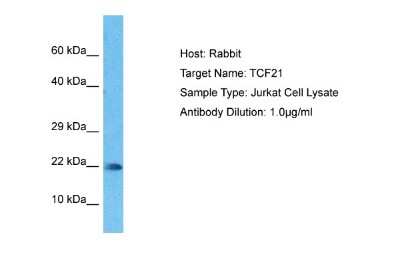 Western Blot: TCF21 Antibody [NBP2-83632]