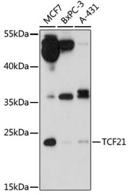 Western Blot: TCF21 AntibodyAzide and BSA Free [NBP2-93154]