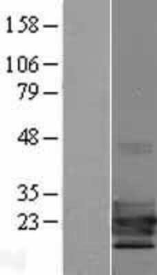 Western Blot: TCF21 Overexpression Lysate [NBP2-10082]