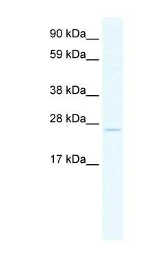 Western Blot: TCF23 Antibody [NBP1-91533]