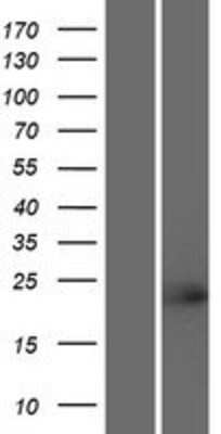 Western Blot: TCF23 Overexpression Lysate [NBP2-05050]