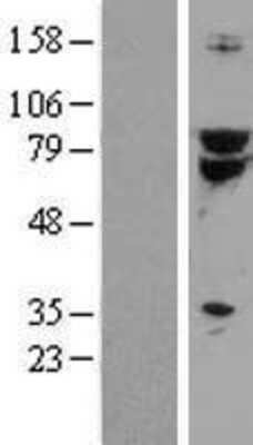 Western Blot: TCF-3/E2A Overexpression Lysate [NBL1-16774]