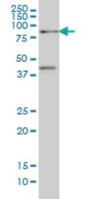 Western Blot: TCF4 Antibody (1F6) [H00006925-M02]