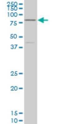 Western Blot: TCF4 Antibody (1G4) [H00006925-M03]