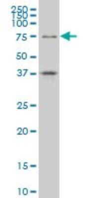 Western Blot: TCF4 Antibody (3E10) [H00006925-M01]