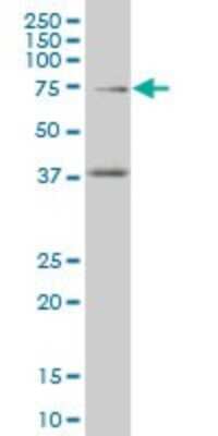 Western Blot: TCF4 Antibody (3H4) [H00006925-M04]