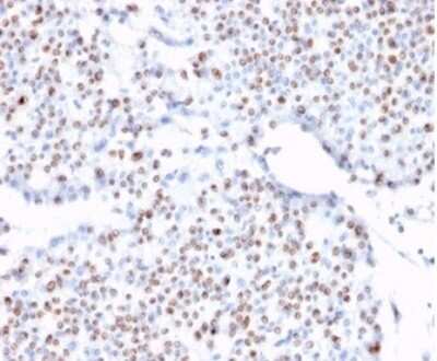 Immunohistochemistry-Paraffin: TCF4 Antibody (TCF4/1705) - Azide and BSA Free [NBP3-08236]