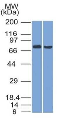 Western Blot: TCF4 Antibody (TCF4/1705)Azide and BSA Free [NBP3-08236]