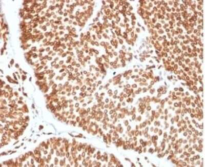 Immunohistochemistry-Paraffin: TCF4 Antibody (TCF4/2252) [NBP3-13789]