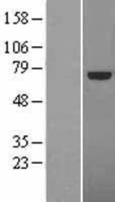 Western Blot: TCF4 Overexpression Lysate [NBL1-16775]