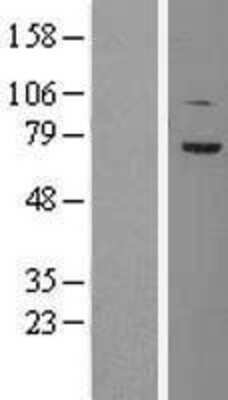 Western Blot: TCF4 Overexpression Lysate [NBL1-16776]