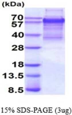 SDS-PAGE: Recombinant Human TCF4 His Protein [NBP2-51618]