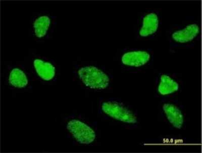 Immunocytochemistry/ Immunofluorescence: TCF7/TCF1 Antibody (1D2) [H00006932-M01]