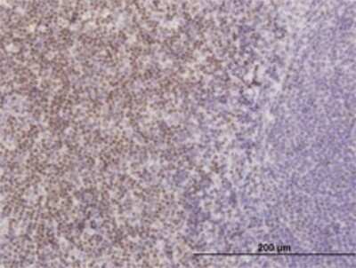 Immunohistochemistry-Paraffin: TCF7/TCF1 Antibody (2E9) [H00006932-M02]