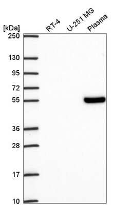 Western Blot: TCF7/TCF1 Antibody [NBP2-57570]