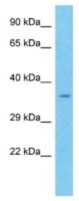 Western Blot: TCF7/TCF1 Antibody [NBP3-10110]