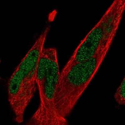 Immunocytochemistry/ Immunofluorescence: TCF7L1/TCF3 Antibody [NBP2-56055]