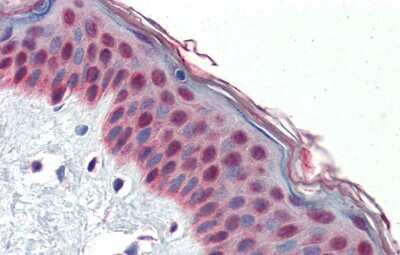 Immunohistochemistry: TCF7L1/TCF3 Antibody [NBP3-10886]