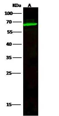 Western Blot: TCF7L1/TCF3 Antibody [NBP2-98907]