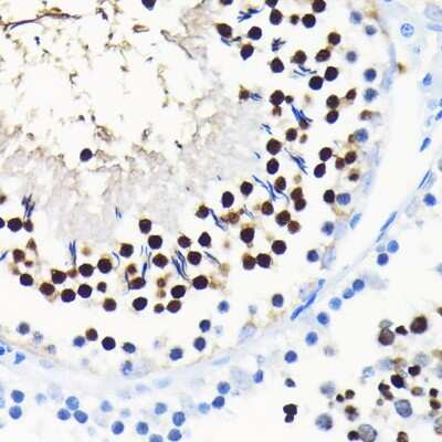 Immunohistochemistry-Paraffin: TCF7L2 Antibody (1W10T6) [NBP3-15768]