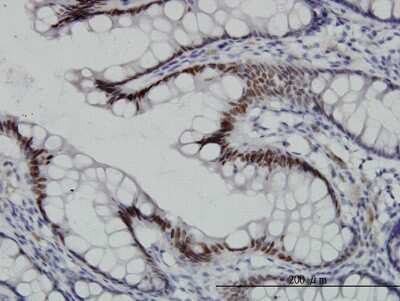 Immunohistochemistry-Paraffin: TCF7L2 Antibody (3A4) [H00006934-M06]