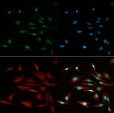 Immunocytochemistry/ Immunofluorescence: TCF7L2 Antibody - BSA Free [NBP1-19083]