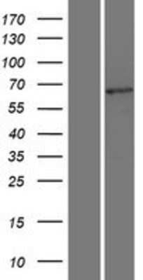 Western Blot: TCF7L2 Overexpression Lysate [NBL1-16777]