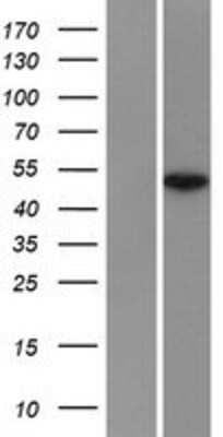 Western Blot: TCF7L2 Overexpression Lysate [NBP2-10147]